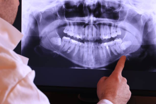 Best Emergency Dental Surgery in Iron Mountain, MI