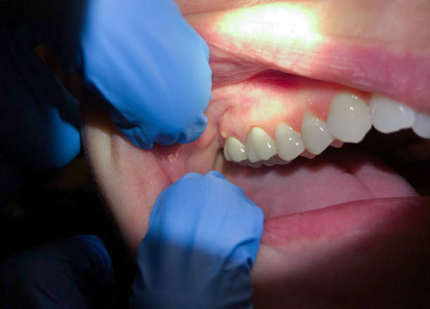 Best Weekend Emergency Dentist in Iron Mountain, MI