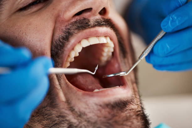 Best Emergency Treatment for Toothache in Iron Mountain, MI